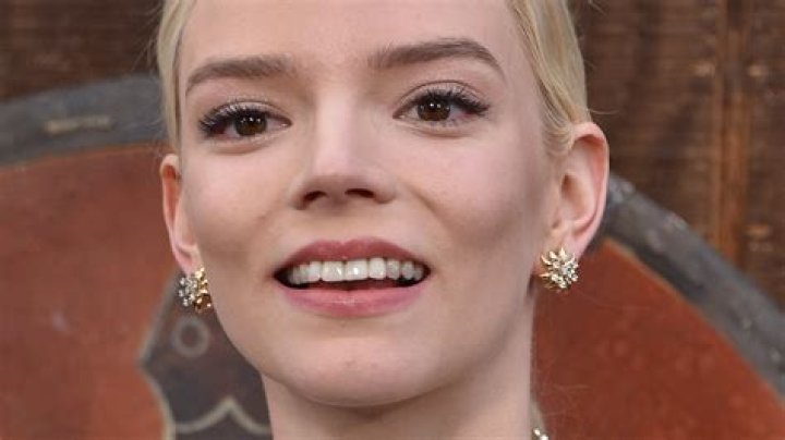 Anya Taylor-Joy's Teeth Accident: Uncovering The Untold Story