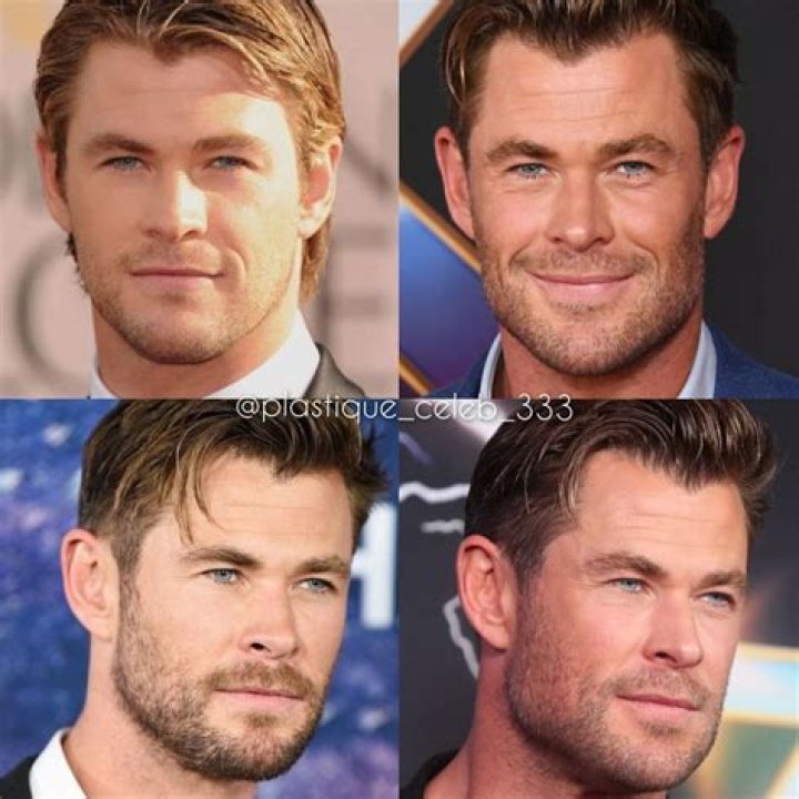 Chris Hemsworth's Plastic Surgery Journey: Unveiling The Truths