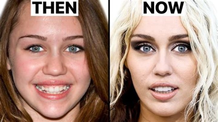 Did She Have Plastic Surgery? What happened to her? |