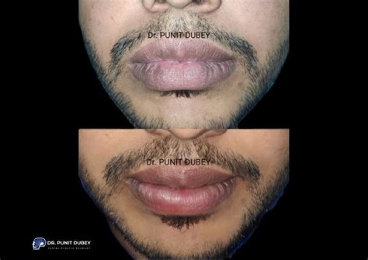 Discoveries And Insights For Enhanced Lip Health