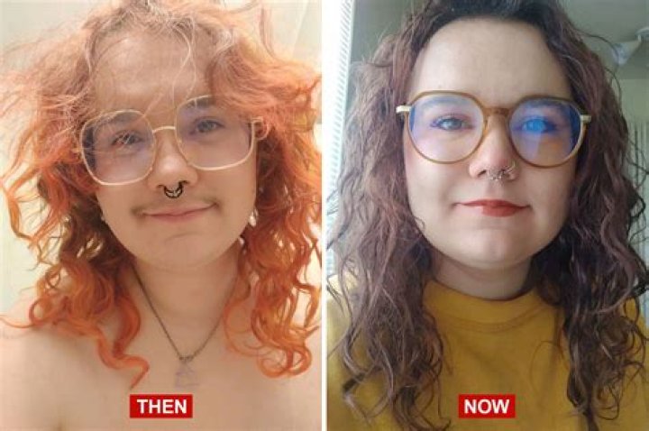 Discoveries And Insights Into Transgender Transitions