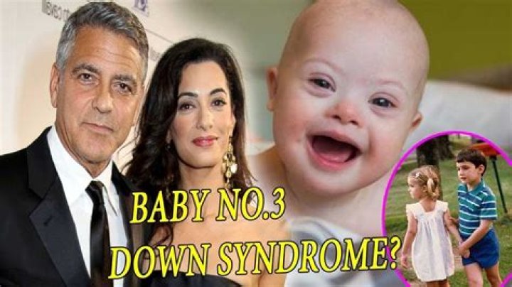 George Clooney And Down Syndrome