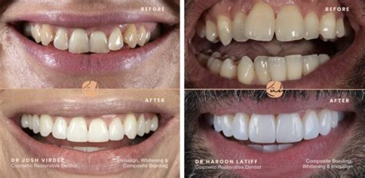 Hitman Holla Teeth; What Happened To Them?