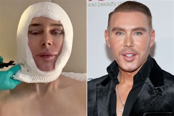 Secrets Of His Plastic Surgery Revealed