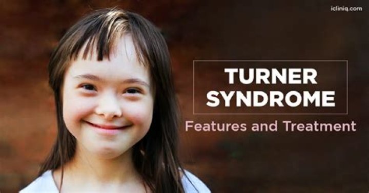 Turner Syndrome Through Inspiring Faces