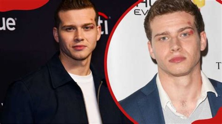 Uncover The Enigmatic Truths Of Oliver Stark's Relationships