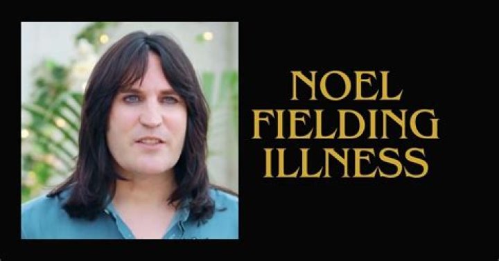 Unveiling Noel Fielding's Illness: Insights And Revelations