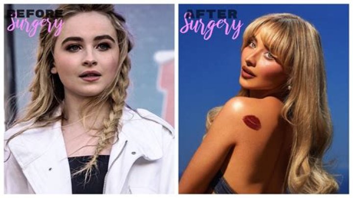 Unveiling Sabrina Carpenter's Plastic Surgery Journey