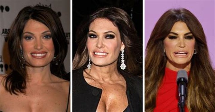 Unveiling The Enigma: Kimberly Guilfoyle's Transformation Exposed