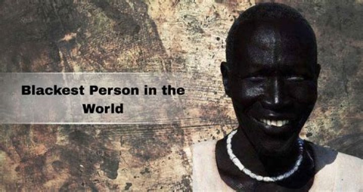 Who is the Blackest Person in the World? The Truth Behind the Viral Photos |