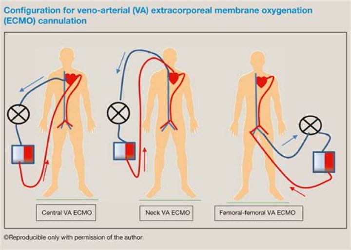 Who is Veno Miller biological father? Who is Veno Miller mom? |