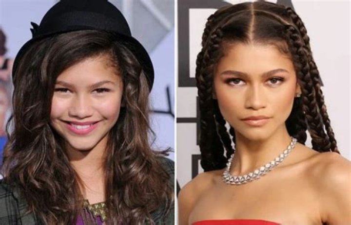 Zendaya Nose Job: Uncovering Truth And Insights